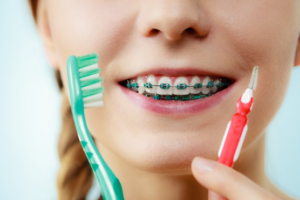 Close up of woman holding toothbrush and interdental brush up to her braces